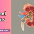Renal Puns